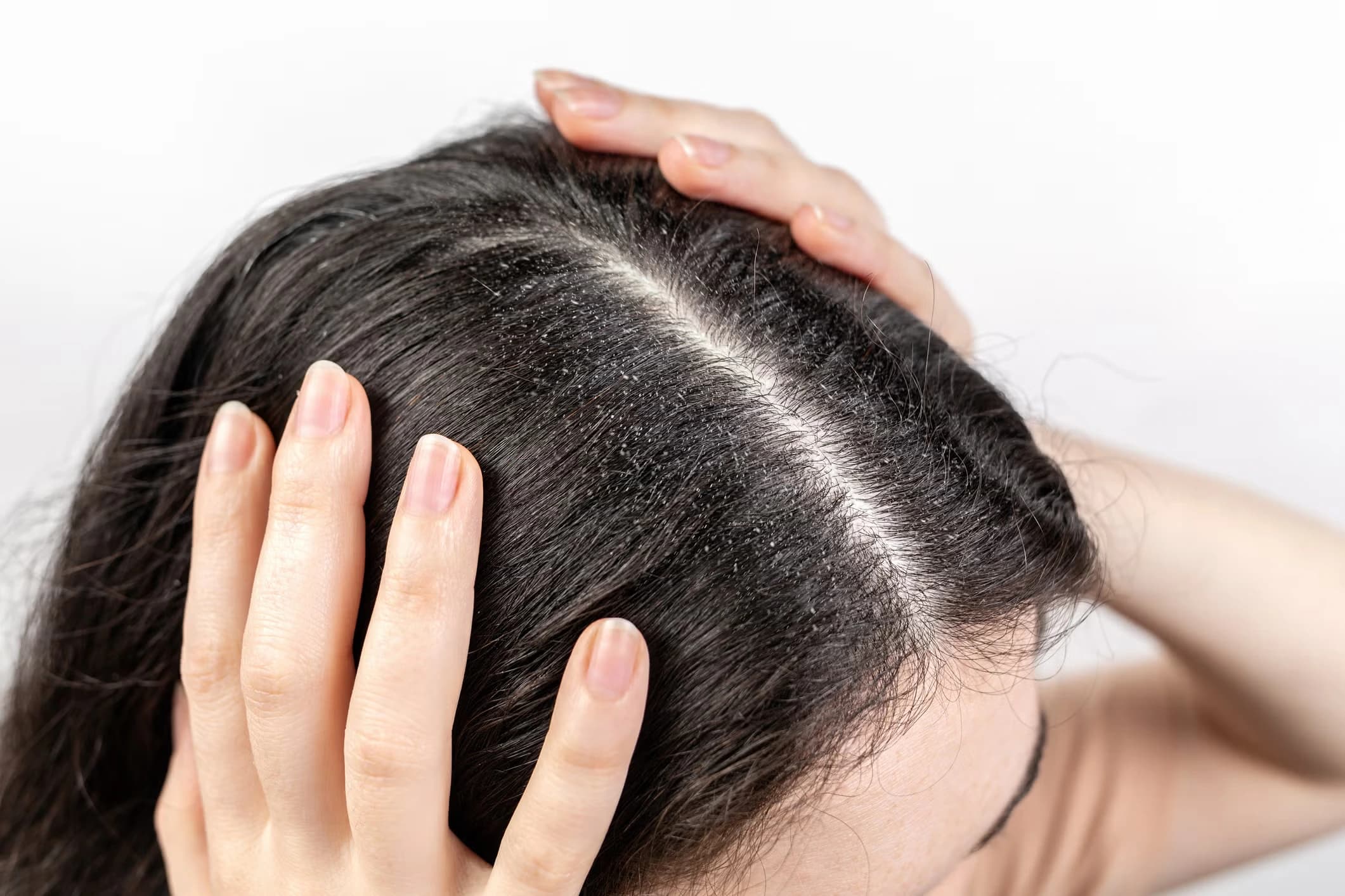 Hair & Scalp Conditions